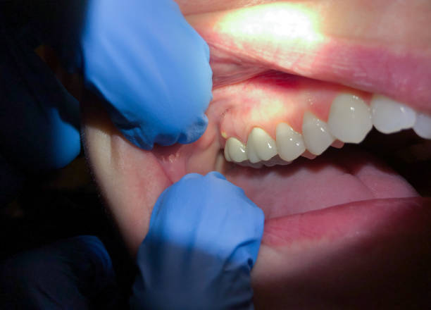 Best Emergency Cosmetic Dentistry (e.g., broken veneers) in Anna, IL