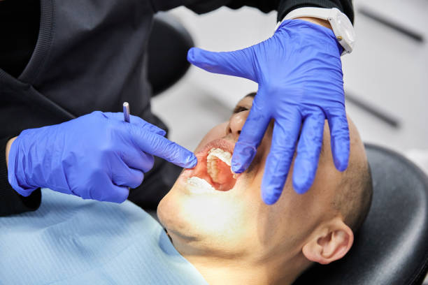 Best Emergency Root Canal Therapy in Anna, IL